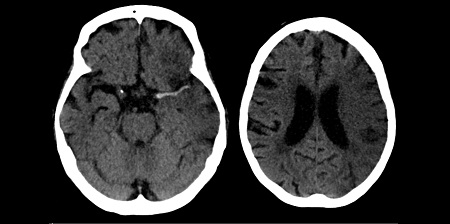 Human Brain Project