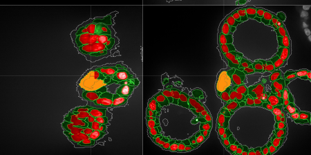 Software di analisi dell'imaging cellulare taglia i tempi della ricerca
