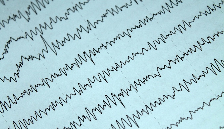 Identificare l’Alzheimer