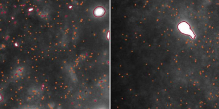 oligomeri nel tessuto cerebrale