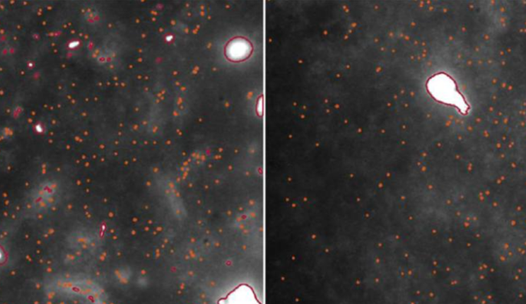 oligomeri nel tessuto cerebrale