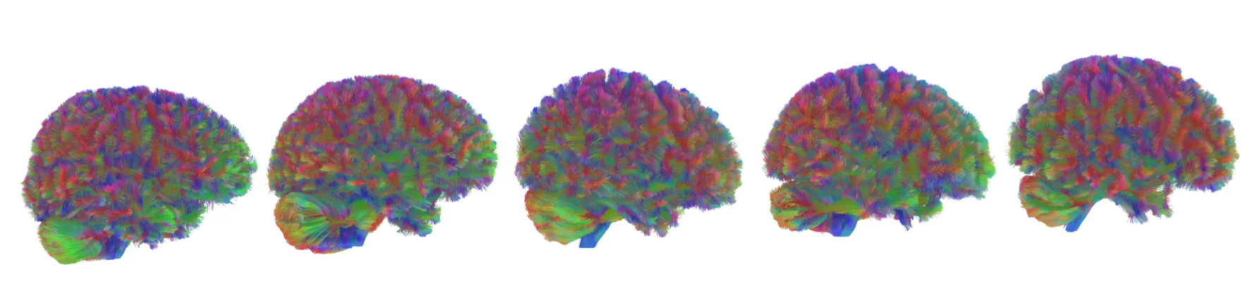 età cervello Cambridge Uni