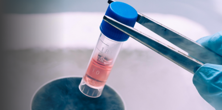 crioconservazione cellulare