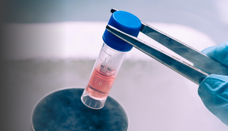 Utilizzo efficace del congelamento ad alta pressione per la crioconservazione cellulare