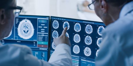 dilatazione delle arterie ictus
