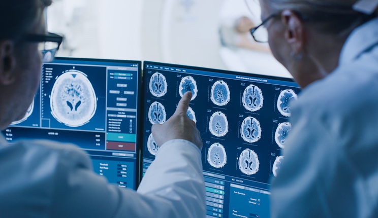 La dilatazione delle arterie, non l’ostruzione, è collegata a un tipo di ictus comune