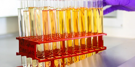 cellule zombie test urine università cambridge