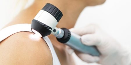tatuaggio intelligente smear ulm