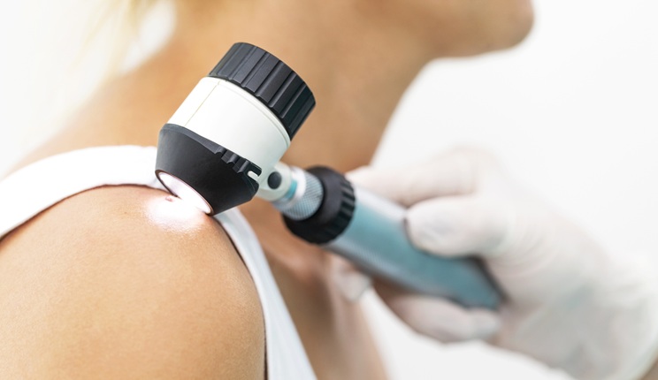 Un “tatuaggio intelligente” individua il cancro della pelle prima che si manifesti