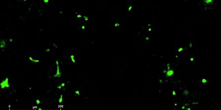 immunoterapie velia siciliano iit