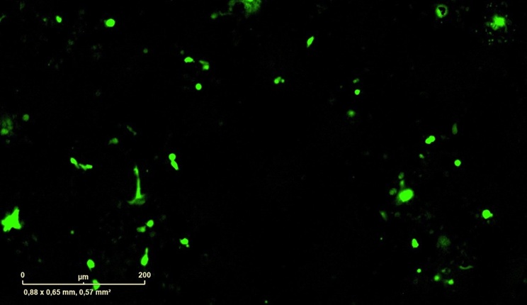 Dall’Istituto Italiano di Tecnologia una nuova strategia contro i tumori: le immunoterapie con l’interruttore