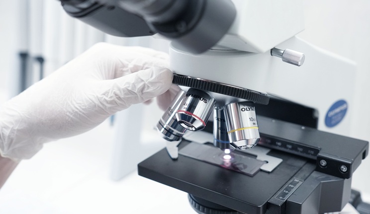 L’accumulo di proteine può influenzare la risposta ai farmaci antitumorali